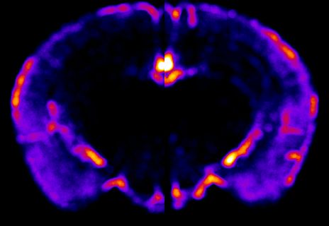 Brain activity mapping during sweep stimulus